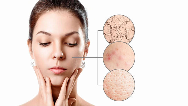 Why Free Radicals Are Bad News For Your Health (And How to Fight Back)
